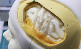 Soft Robotic Electrode Enables Minimally Invasive Placement
