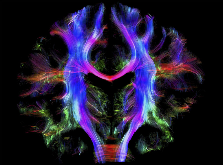 wired-brain