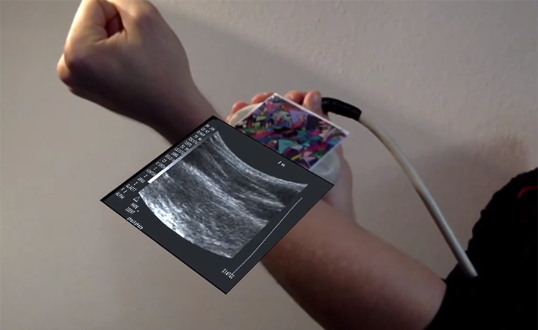 augmented-reality-ultrasound